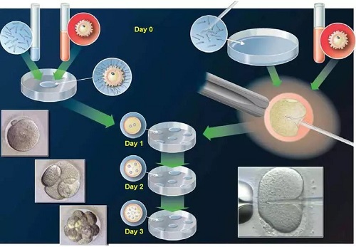 试管婴儿移植前需要做哪些准备